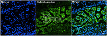 Clathrin Heavy Chain (CLTC) HiRe Antibody - FFPE Validated