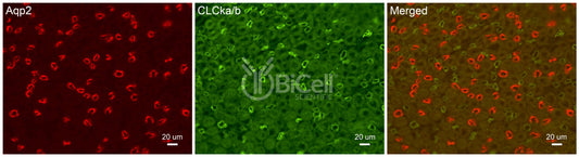 CLC-Ka/b Antibody - Western Blot Validated