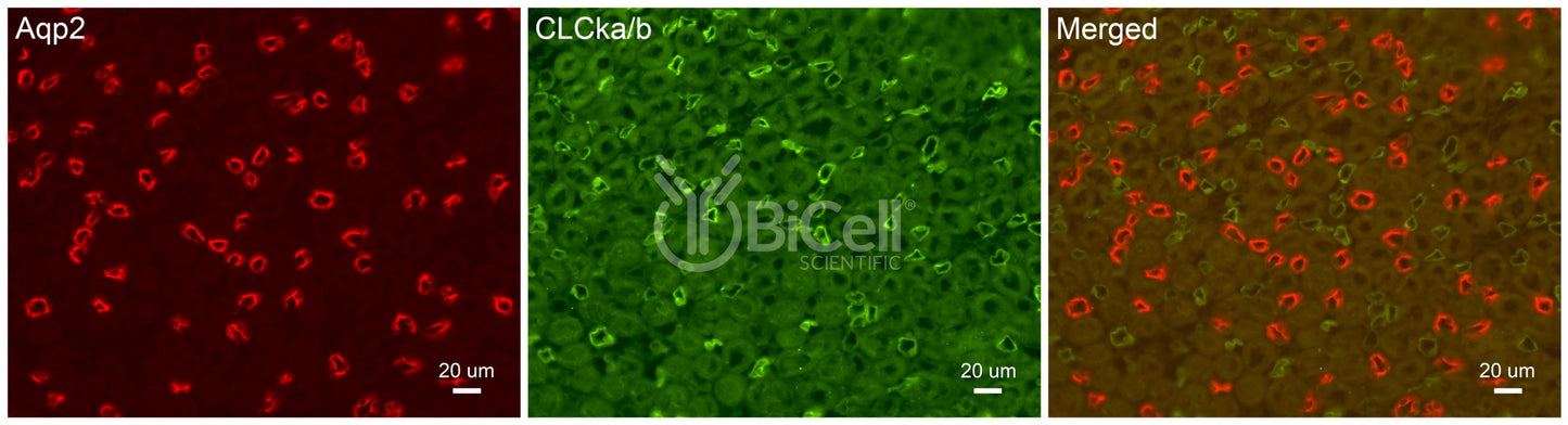 CLC-Ka/b Antibody