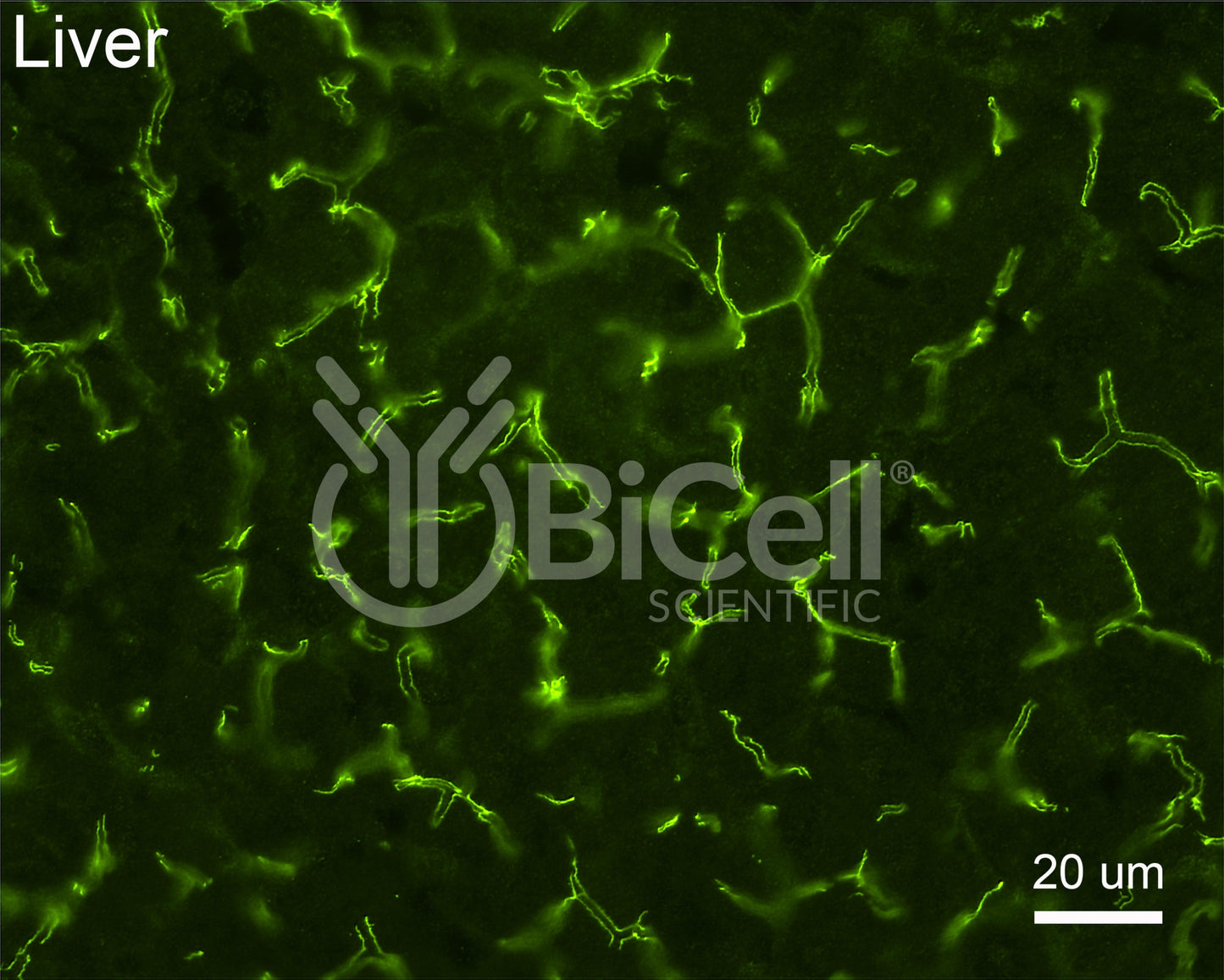 Claudin-1 (CLDN1) Antibody