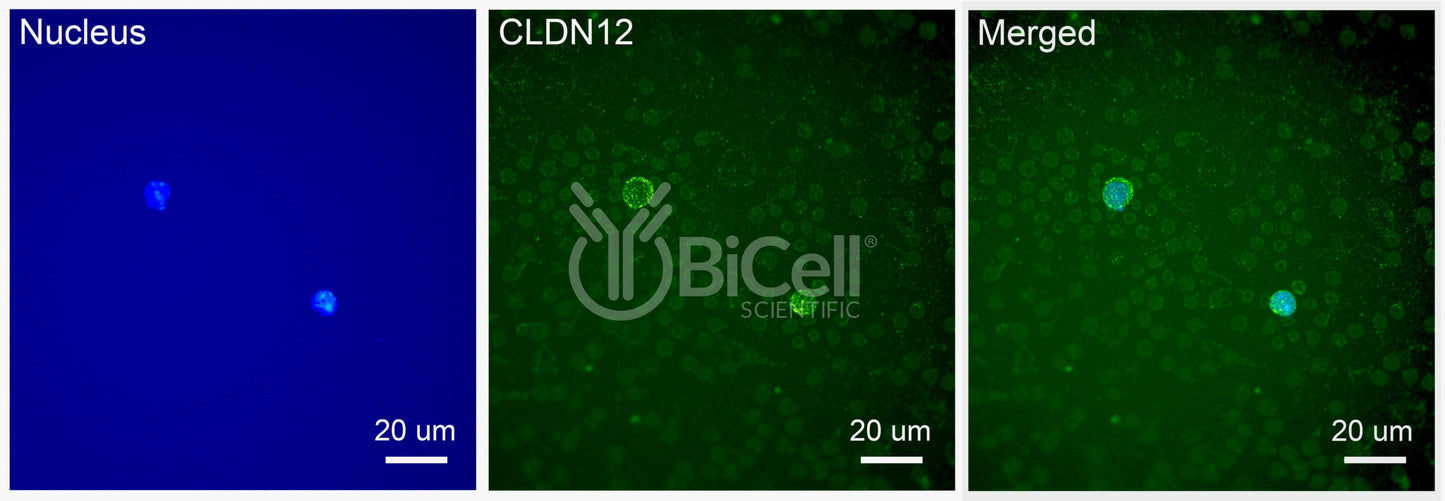 Claudin-12 (CLDN12) Antibody - FFPE Validated