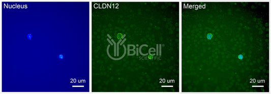 Claudin-12 (CLDN12) Antibody - FFPE Validated
