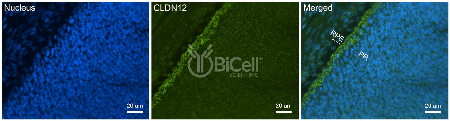 Claudin-12 (CLDN12) Antibody - FFPE Validated