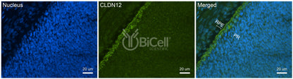Claudin-12 (CLDN12) Antibody - FFPE Validated