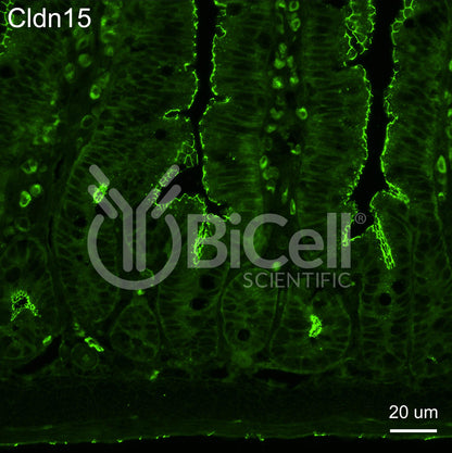 Claudin-15 (CLDN15) Monoclonal Antibody (A10 Clone) - FFPE Validated