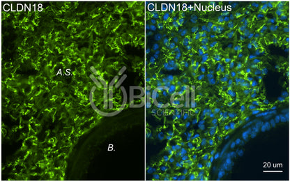 Claudin-18 (CLDN18) Antibody - Western Blot Validated