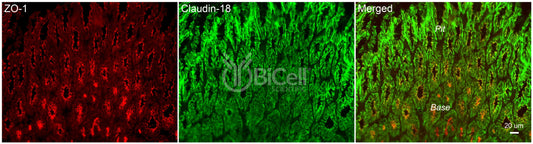 Claudin-18 (CLDN18) Antibody - FFPE Validated