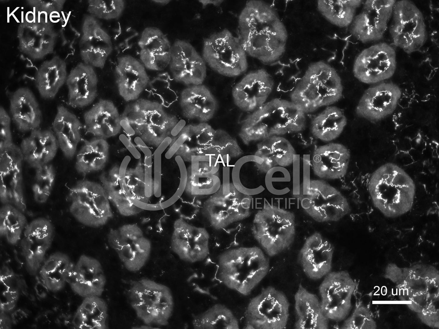 Claudin-19 (CLDN19) Antibody