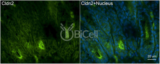 Claudin-2 (CLDN2) Monoclonal Antibody (G2 Clone) - FFPE Validated
