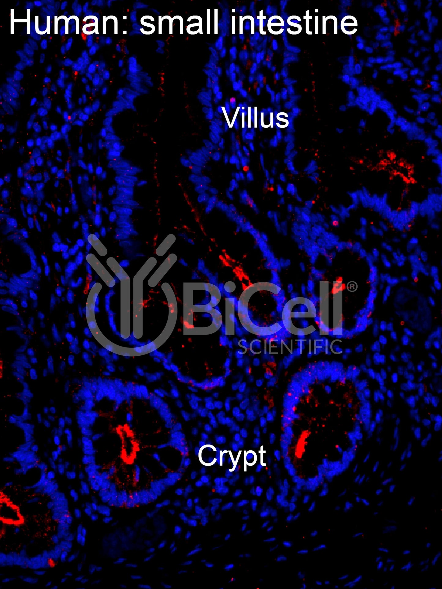 Claudin-2 (CLDN2) Antibody - FFPE Validated
