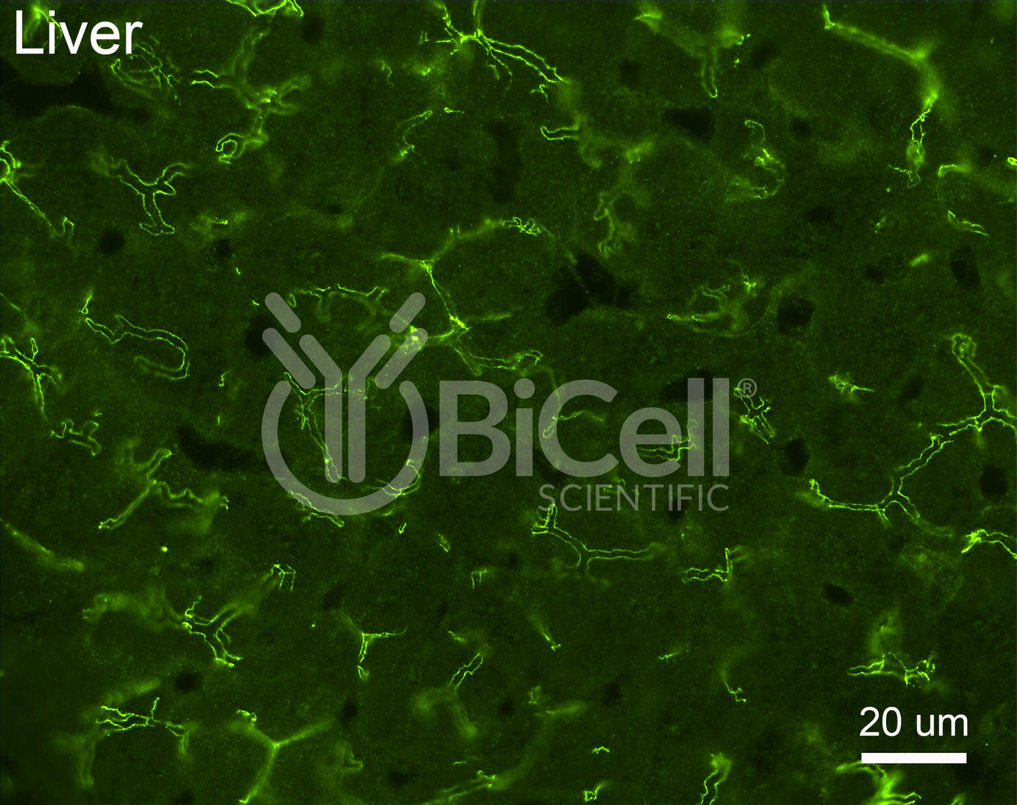 Claudin-2 (CLDN2) Antibody