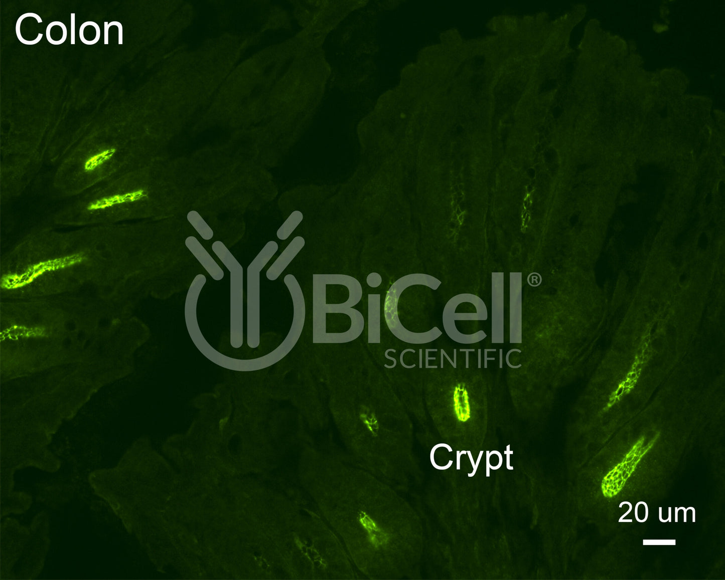 Claudin-2 (CLDN2) Antibody - Western Blot Validated