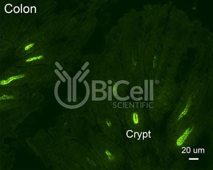 Claudin-2 (CLDN2) Antibody - Western Blot Validated