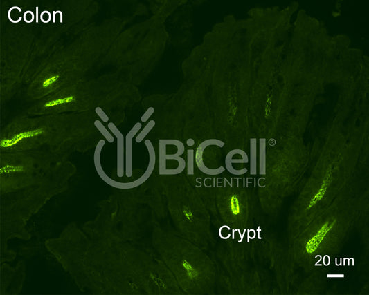 Claudin-2 (CLDN2) Antibody