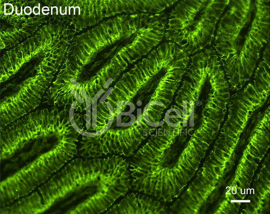 Claudin-3 (CLDN3) Antibody