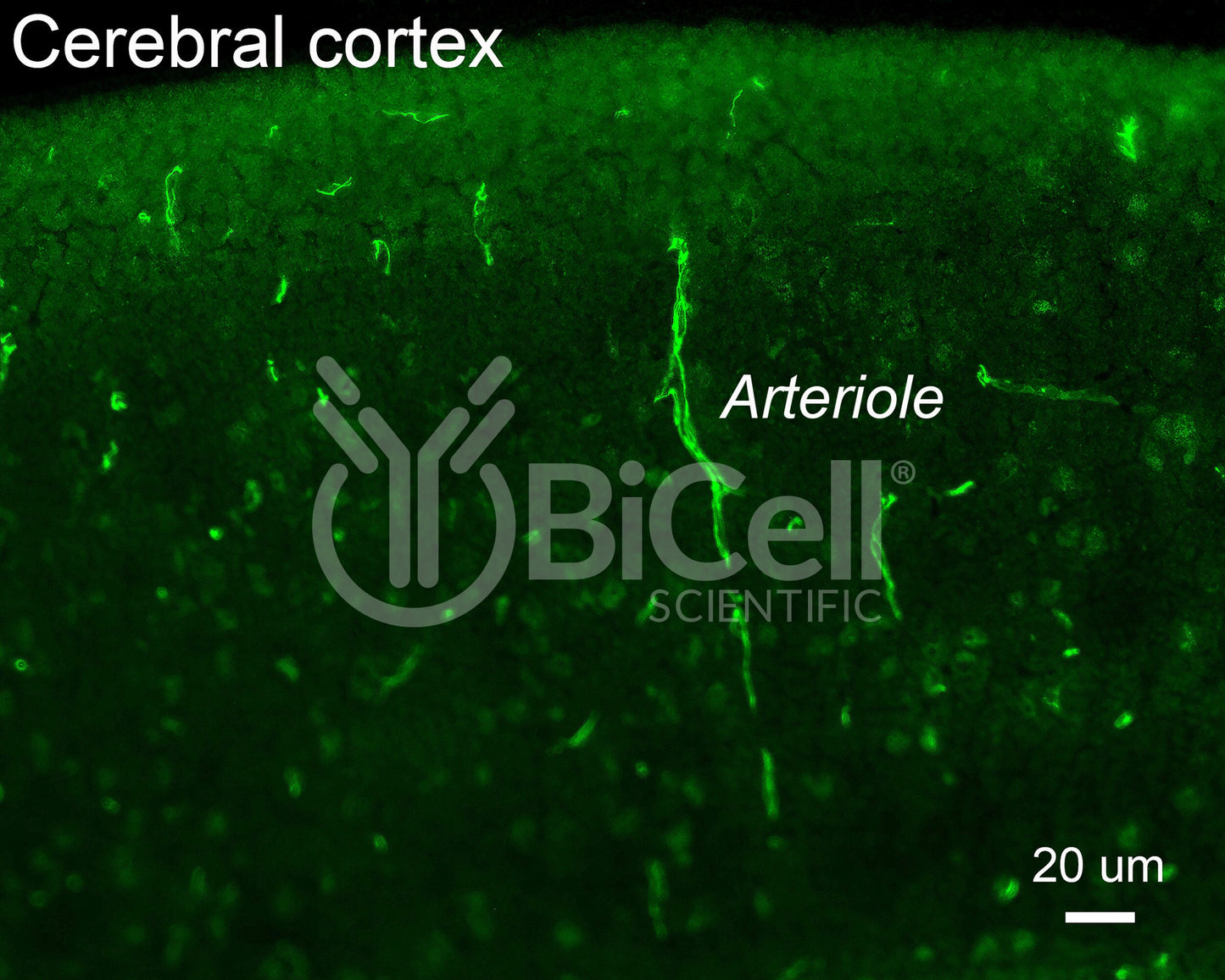 Claudin-5 (CLDN5) Antibody - Western Blot Validated