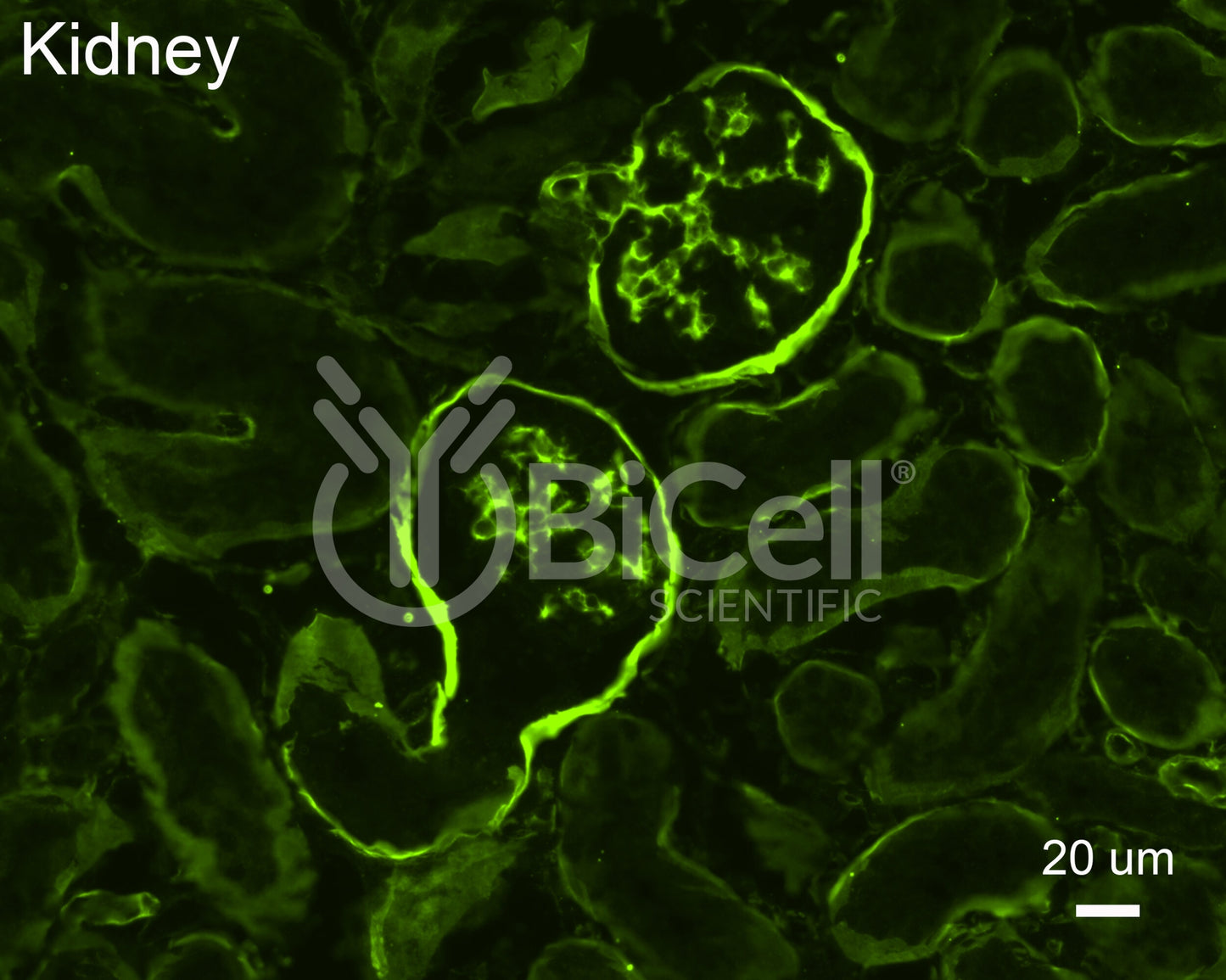Collagen alpha-1 (IV) (Col4a1) Antibody - Western Blot Validated