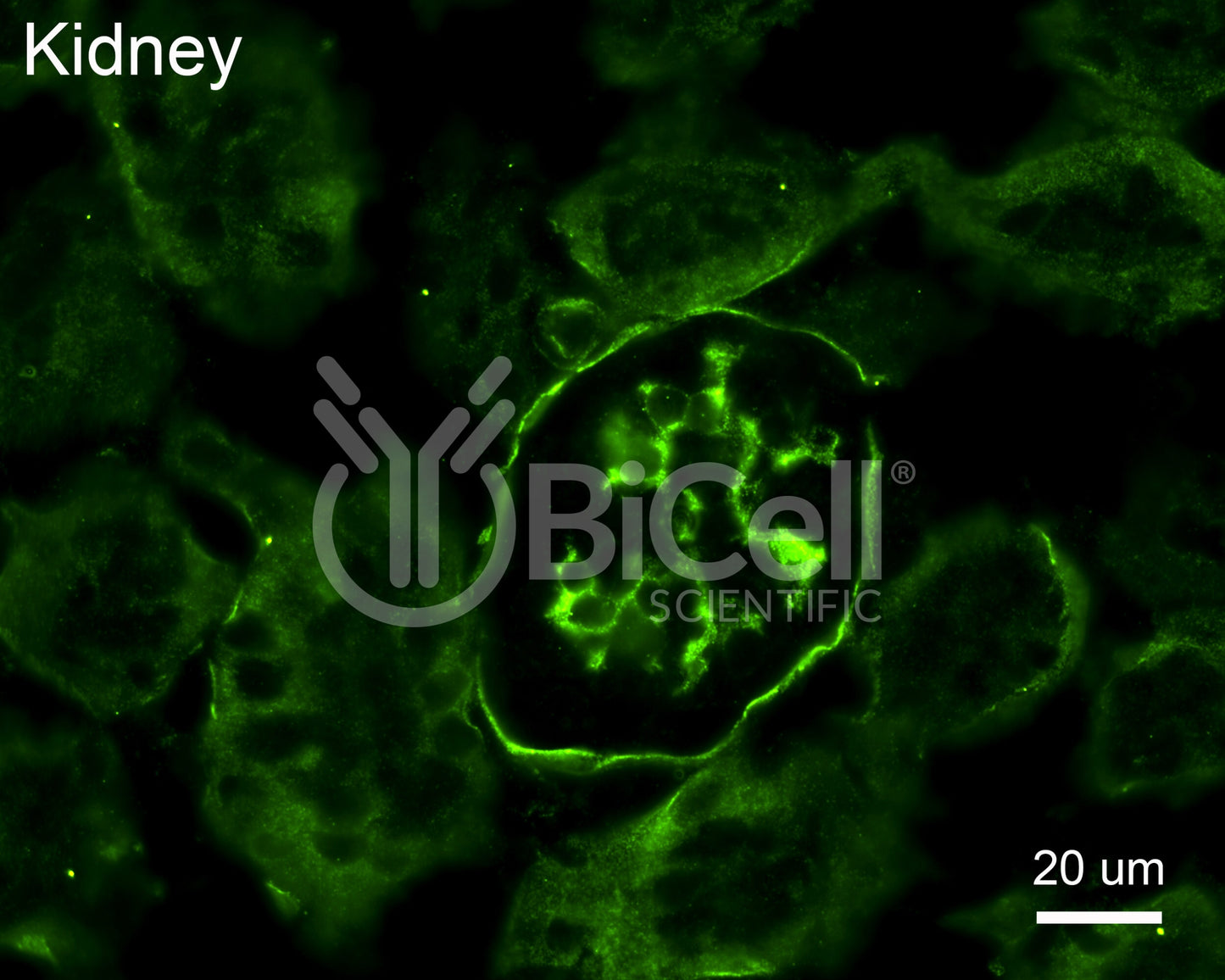 Collagen alpha-2 (IV) (Col4a2) Antibody - Western Blot Validated