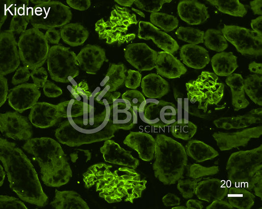 Collagen alpha-4 (IV) (Col4a4) Antibody - Western Blot Validated
