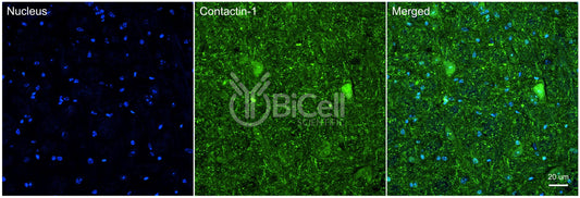 Contactin-1 (CNTN1 or GP135) Antibody - Western Blot Validated
