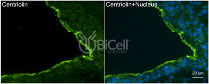 Centriolin (CEP110) Antibody - FFPE Validated