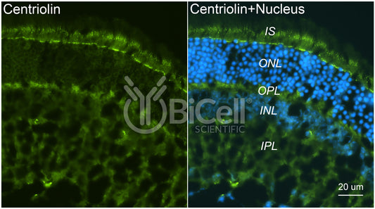 Centriolin (CEP110) Antibody