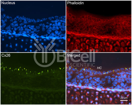 Connexin-26 (Cx26 or Gjb2) Antibody - FFPE Validated