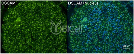 DSCAM Antibody - Western Blot Validated