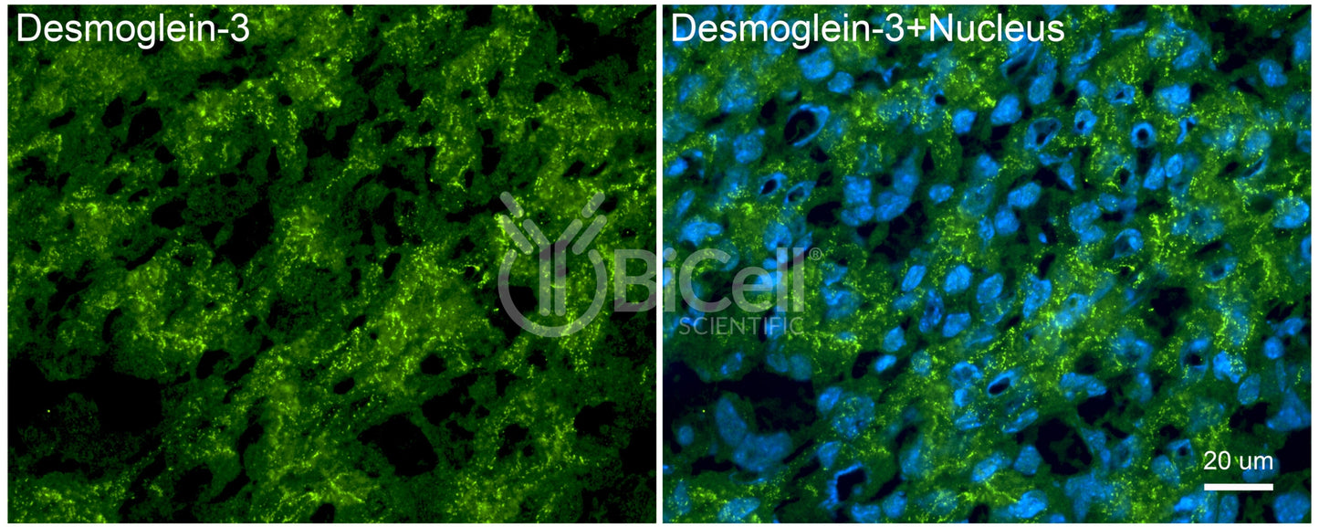 Desmoglein-3 (DSG3) Antibody - Western Blot Validated