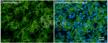 Desmoglein-3 (DSG3) Antibody - FFPE Validated