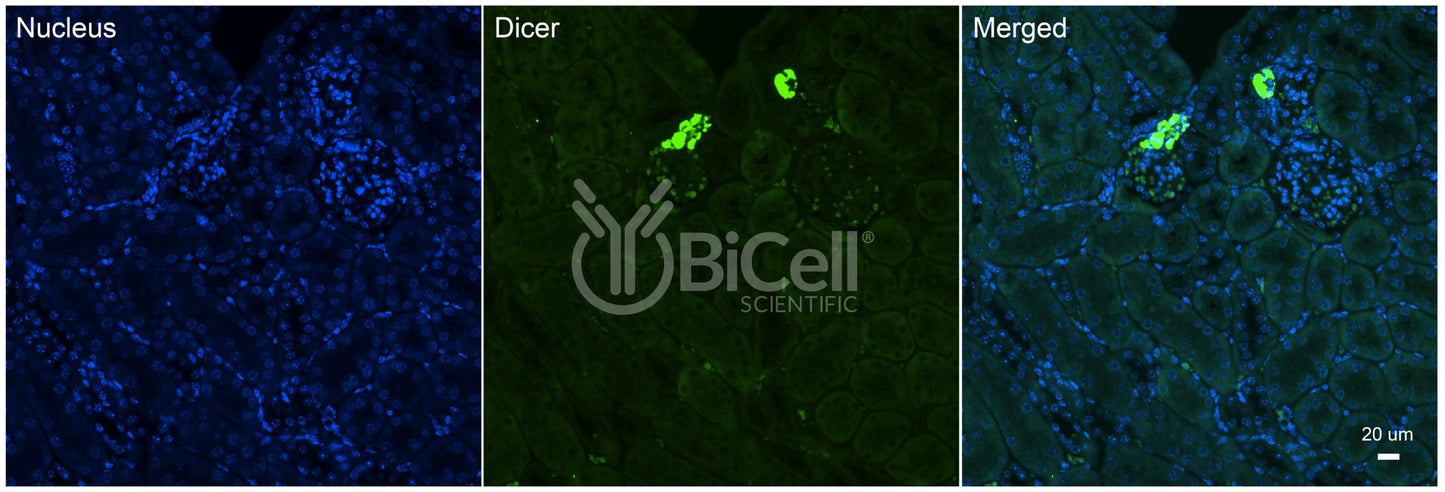 Dicer (DICER1 or DCR1) Antibody - Western Blot Validated