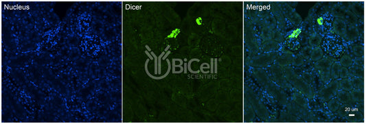 Dicer (DICER1 or DCR1) Antibody - FFPE Validated