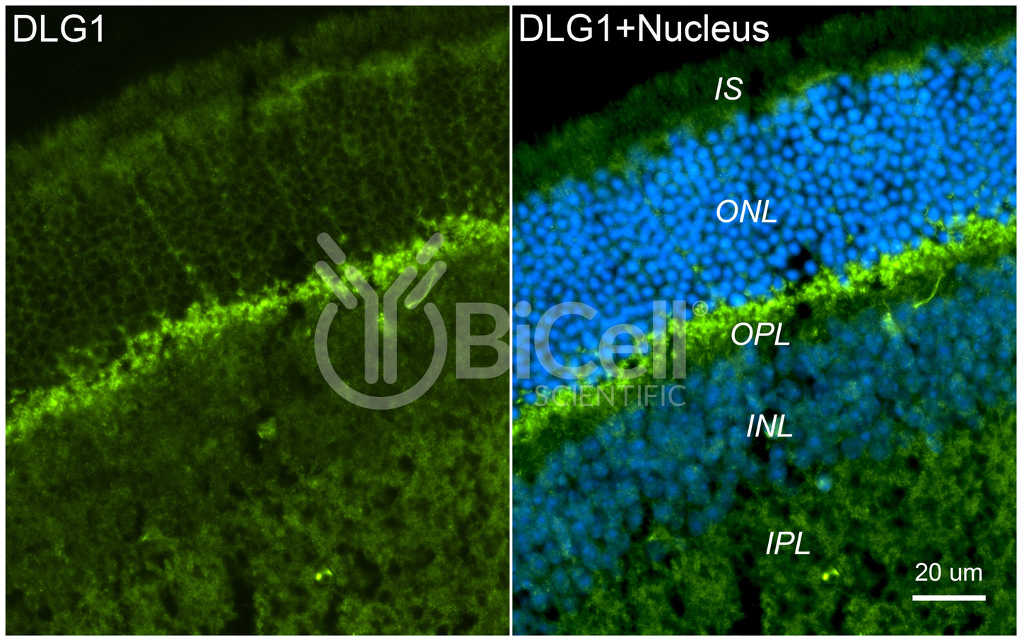 DLG1 (SAP97) Antibody - FFPE Validated