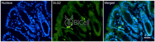 DLG2 (PSD-93 or chapsyn-110) Antibody
