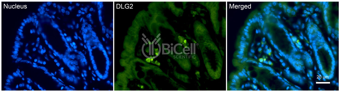 DLG2 (PSD-93 or chapsyn-110) Antibody - FFPE Validated