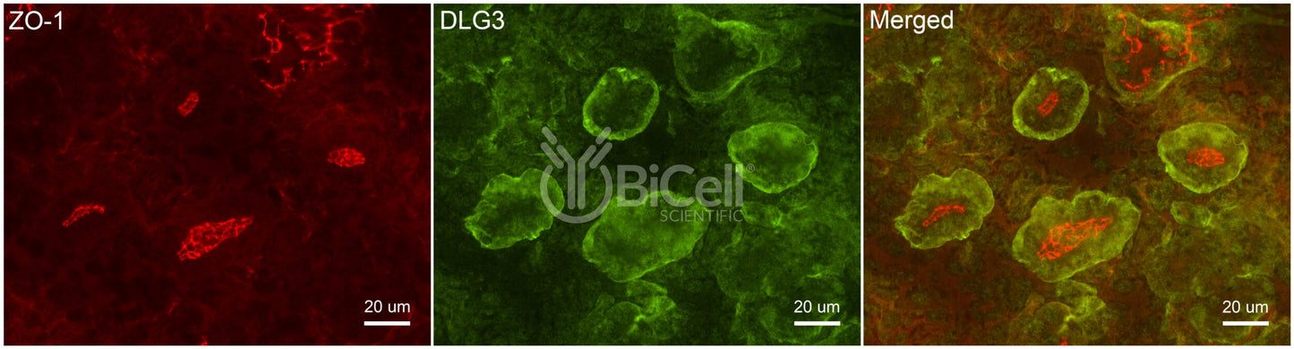 DLG3 (SAP-102 or NEDLG) Antibody - FFPE Validated