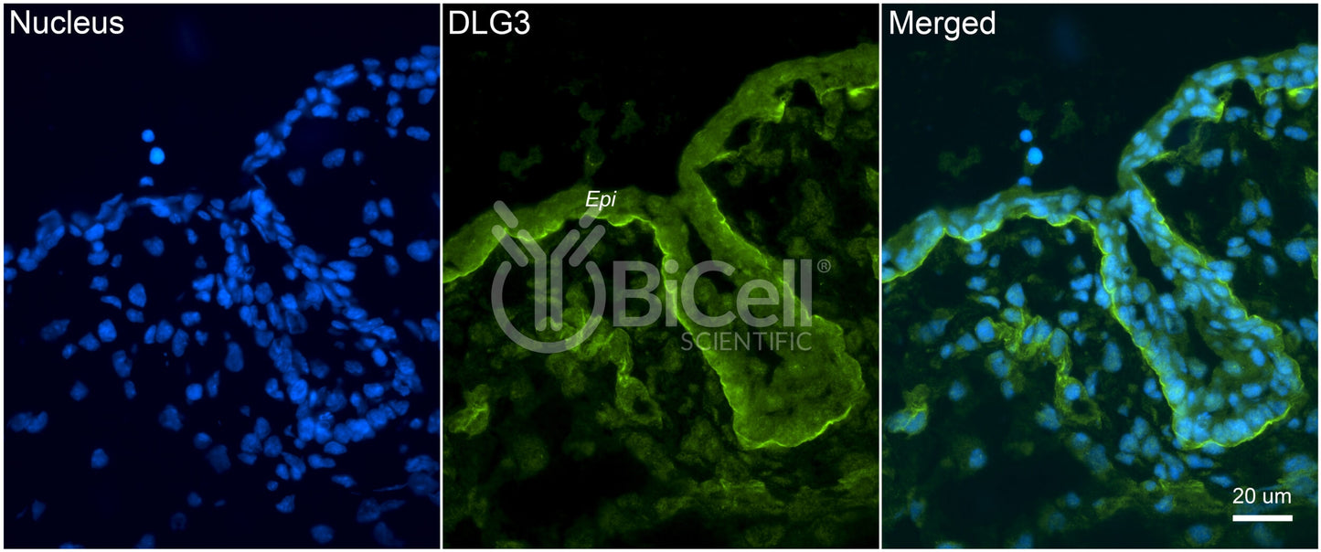 DLG3 (SAP-102 or NEDLG) Antibody - FFPE Validated