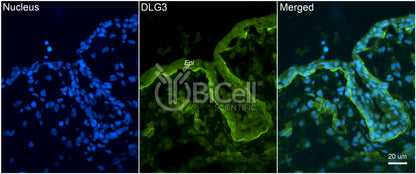 DLG3 (SAP-102 or NEDLG) Antibody - FFPE Validated