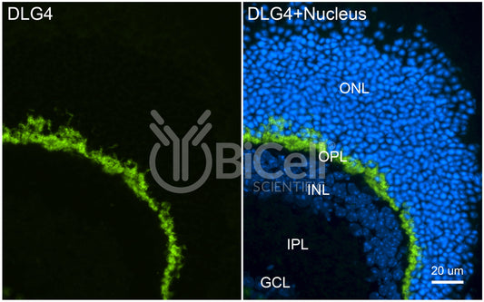 DLG4 (SAP-90 or PSD-95) Antibody - FFPE Validated