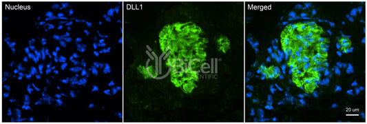 DLL1 (Delta1 or Delta) Antibody - FFPE Validated