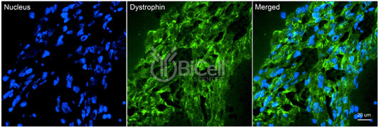 Dystrophin (DMD) Antibody - Western Blot Validated