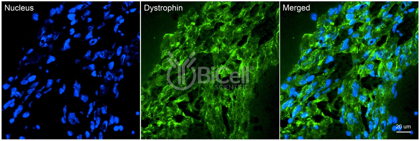 Dystrophin (DMD) Antibody - FFPE Validated