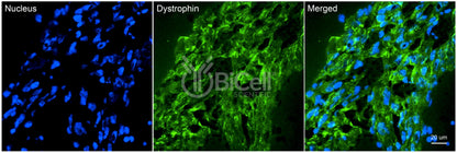 Dystrophin (DMD) Antibody