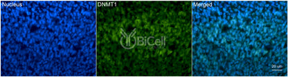 DNMT1 (DNMT) Antibody