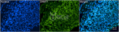 DNMT1 (DNMT) Antibody - FFPE Validated