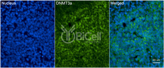 DNMT3A Antibody - FFPE Validated