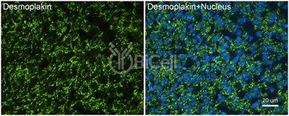 Desmoplakin (DSP) Antibody - FFPE Validated