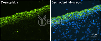Desmoplakin (DSP) Antibody - Western Blot Validated