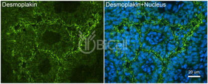 Desmoplakin (DSP) Antibody - Western Blot Validated
