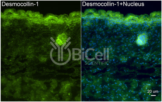 Desmocollin-1 (DSC1) Antibody